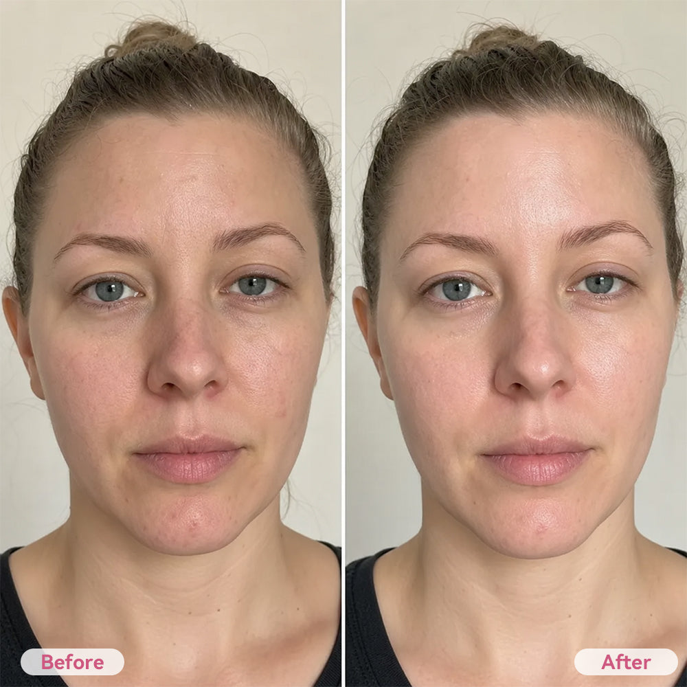 Before and after cosmetic appearance example