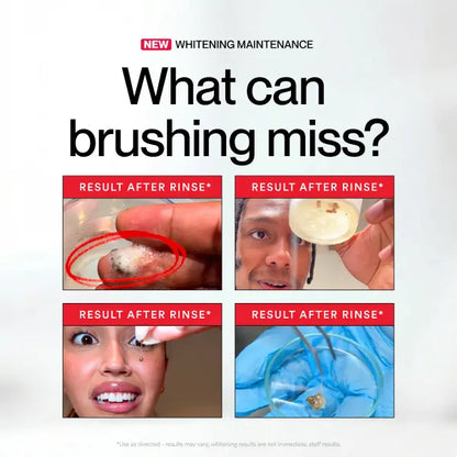 iD Stain Whitening Mouthwash for White Teeth, Freshens Breath