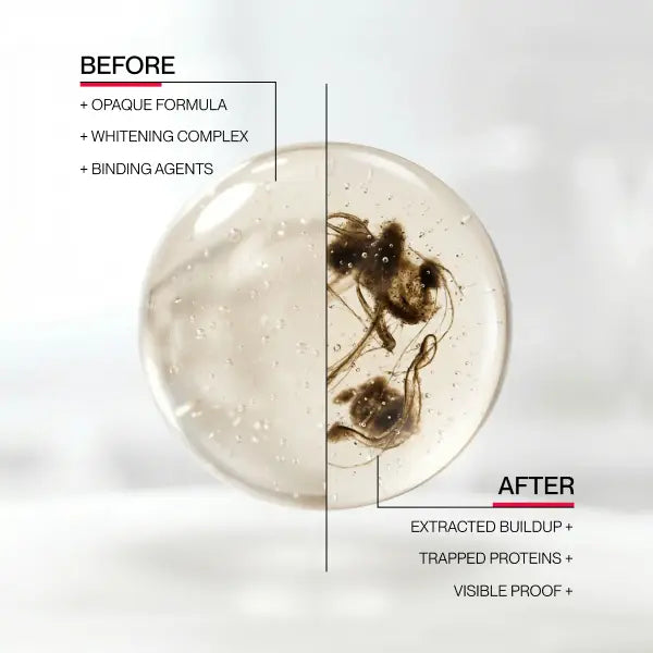 iD Stain Whitening Mouthwash for White Teeth, Freshens Breath