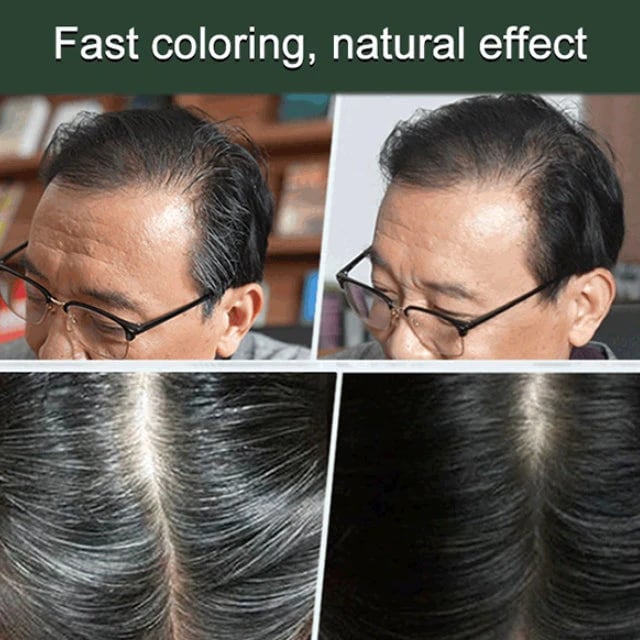 Last Day 49% OFF🔥Fruit Essence Hair Dyeing Comb, Natural Plant Extract Ingredient For All Hair Types