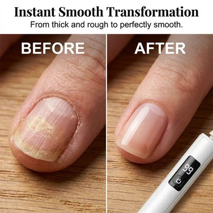 Professional Ultra-Safe LED Electric Nail Grinder